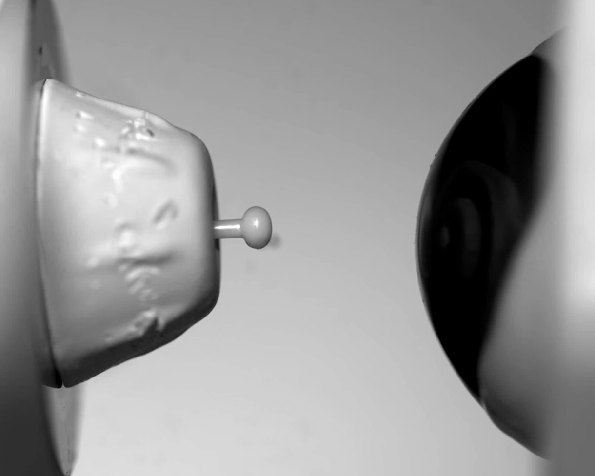 Motion trajectory analysis of medical mechanical action