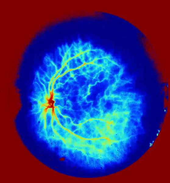 OEM Integration of High-Speed sCMOS Cameras into Multimodal Fundus Imaging Devices